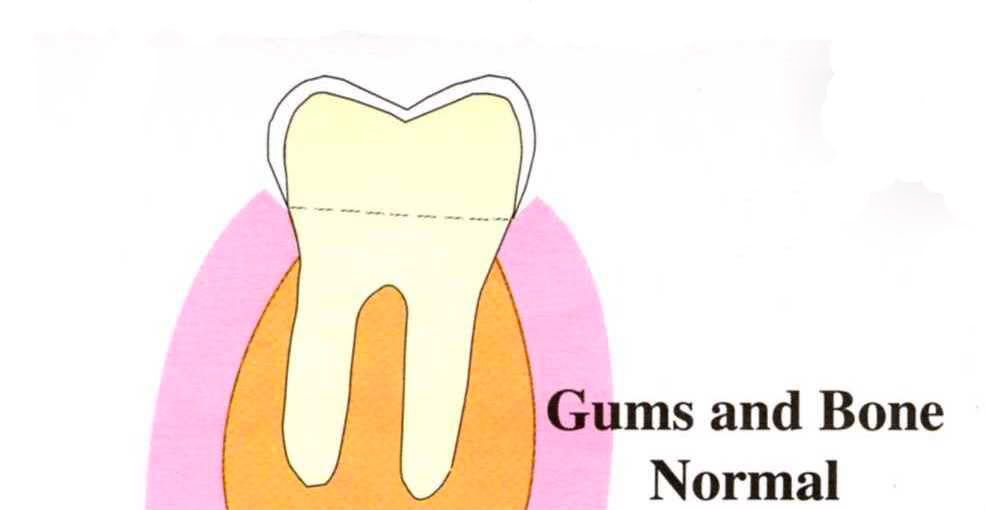 How+to+maintain+healthy+gums+and+teeth